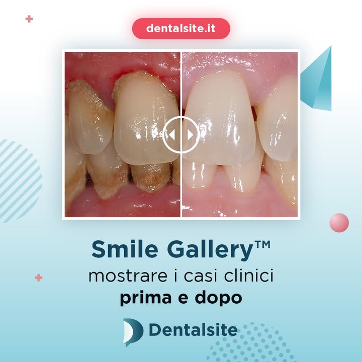 Foto dal post di Dentalsite